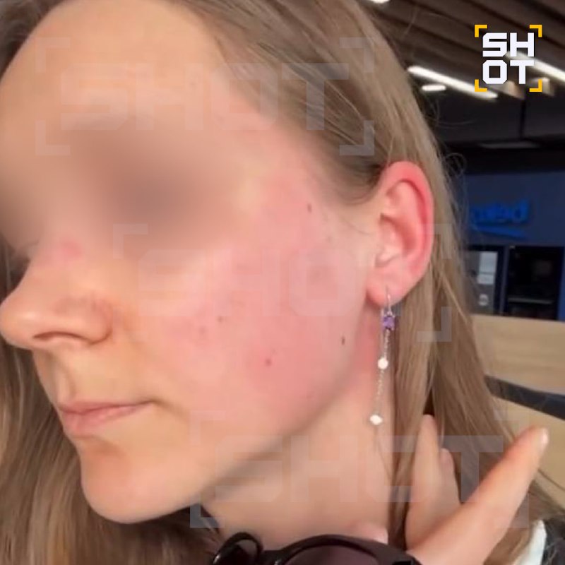 תייר דיווח על מכות בתחנת רכבת בג'ורג'יה. הנערה מאמינה שהסיבה הייתה דיבור רוסי לפי בעיטה, אלכסנדרה ממינסק הי…