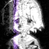 whyfault