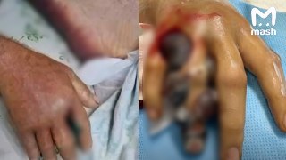 Шансы умереть от укуса самой ядовитой змеи — гюрзы — выросли в десять раз у туристов Дагестана. 2026-й стал рекордным по числу нападений за последние 25 лет — гады начали чаще выползать к людям.В начале сентября змея ужалила 10-летнего ребёнка во дворе час