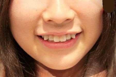 ژاپنی برای همه: مد دندان‌های بد شکلفرهنگ ژاپنی می‌تواند برای مردم سراسر جهان بسیار عجیب باشد. این فرهنگ در همه ابعاد، از سرگرمی تا مد من