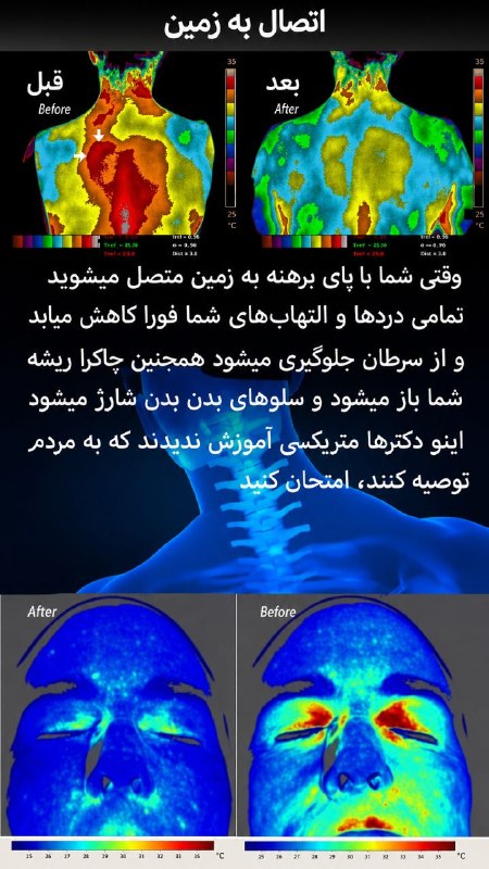 نیایش مسلمیان ( روانشناسی تحلیل یونگ): مزایای اتصال به زمین :کاهش التهابکاهش درد مزمنتسریع التیام - در برخی نقاط برای جلوگیری از زخم بستر استفاده می شودبهبود خ