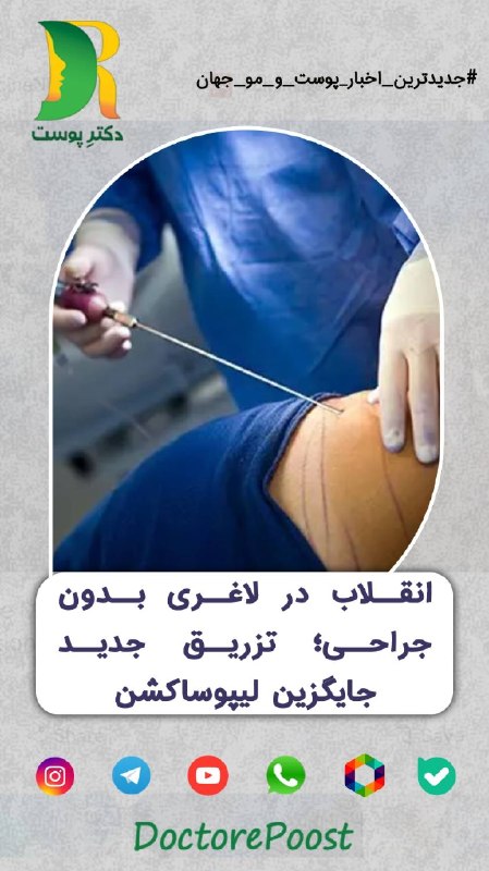 دکتر پوست | DoctorePoost: 🆕 #جدیدترین_اخبار پوست و موی جهان📆تاریخ انتشار در منبع: *فروردین 1405*ا🍃🍃🍃🍃🍃🍃🍃🍃🍃🍃🍃🍃🍃🍃🍃⁉️میخوای بدون جراحی و با کمترین در