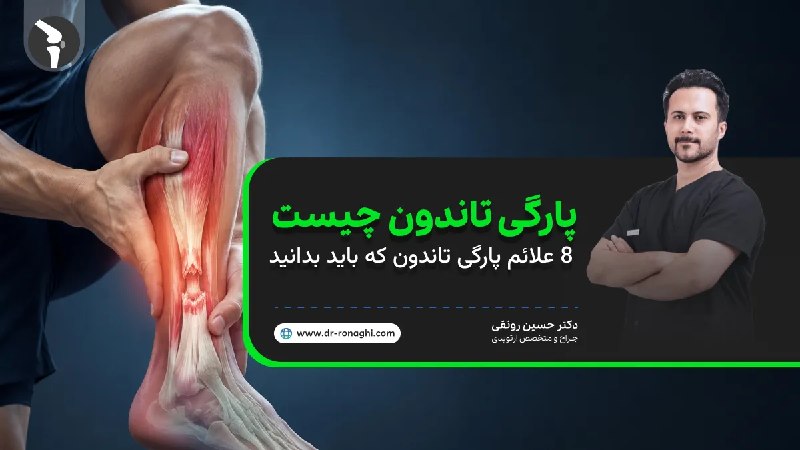 دکتر حسین رونقی متخصص جراحی ارتوپدی: پارگی تاندون چیست و چه علائمی دارد !؟ + (نکات پزشکی)بر اساس آمار و پژوهش‌های انجام‌شده در حوزه ارتوپدی، پارگی‌ تاندون آس