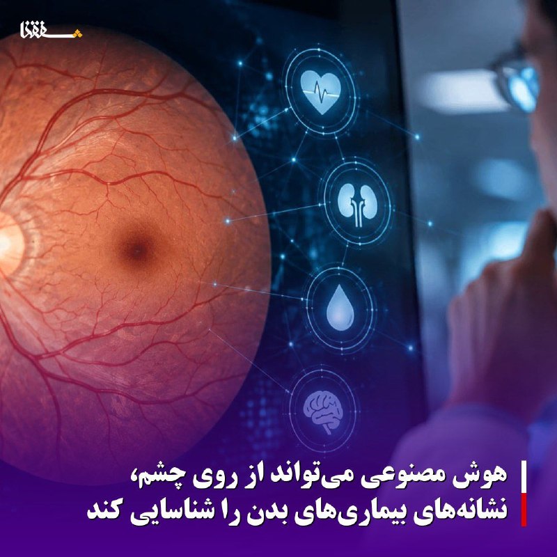 خبرگزاری بین المللی شفقنا: 🔴هوش مصنوعی می‌تواند از روی چشم، نشانه‌های بیماری‌های بدن را شناسایی کندچشم ممکن است اطلاعاتی بسیار فراتر از سلامت بینای