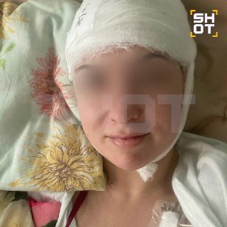 30-летняя жительница Твери перенесла инсульт во время секса и уже третий год проходит восстановление, сообщает SHOT.По данным издания, в тот день Серафима сначала сходила в бассейн, а затем вернулась домой. Во время секса у неё резко участились пульс и сер