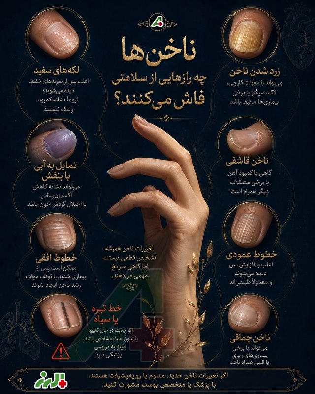 پایگاه خبری البرز: 🟣 گاهی اولین هشدار بدن، درست روی ناخنها ظاهر میشود...@News_Alborz