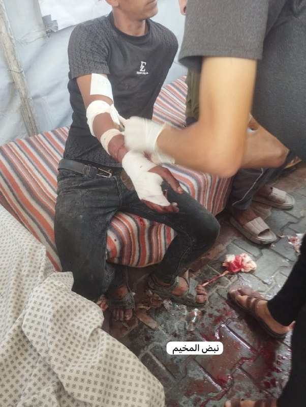 A young man was injured in his hand in the Beit Lahia project as a result of the occupation army's shooting