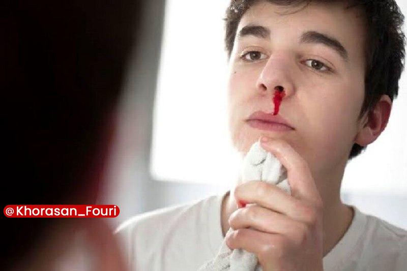 خراسان فوری (مشهد): مسئول آموزش مدیریت حوادث و فوریتهای پزشکی دانشگاه علوم پزشکی مشهد تاکید کرد: اگر عارضه «اپیستاکسی» یا خونریزی بینی بیش