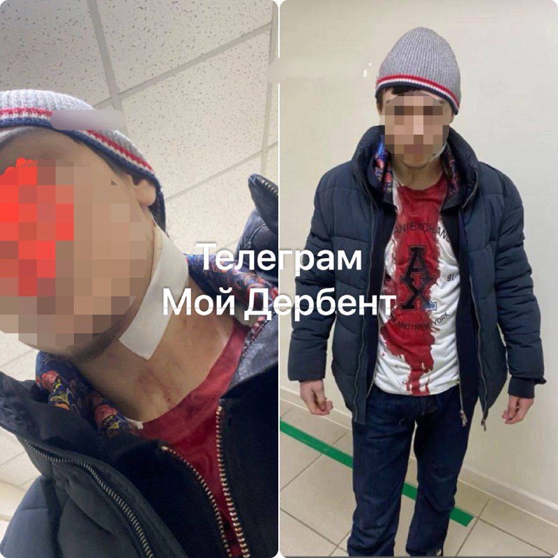 На сторожа, который ударил ножом ученика в школе Дербента, возбудили уголовку о покушении на убийство. фото