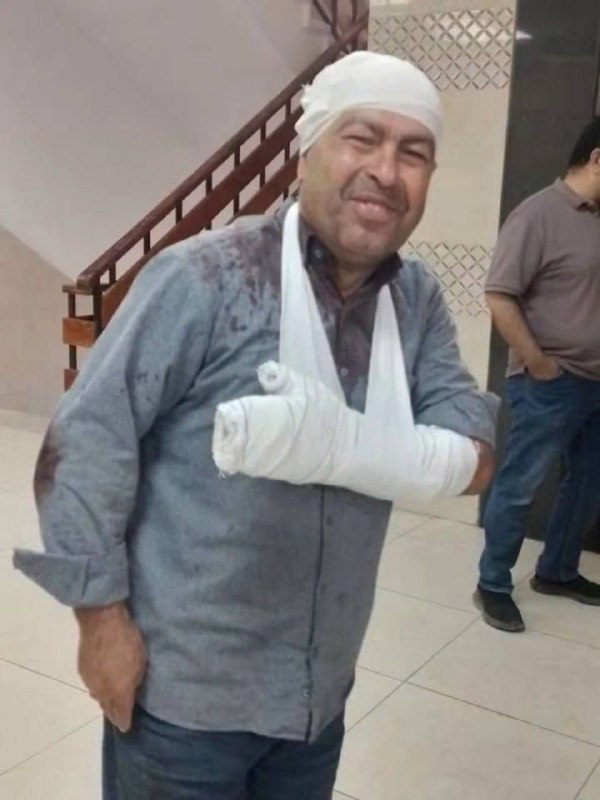 Settlers attacked Professor Sami Nofal and his family members while they were staying on their land in the western industrial area of ​​the town of Deir Sharaf, west of Nablus.