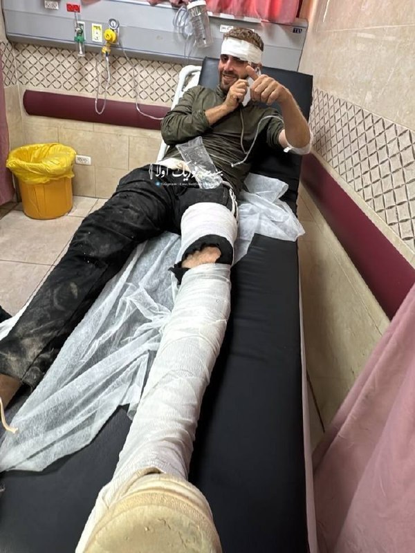 Settlers open fire on Beit Furik, injuring two Palestinians